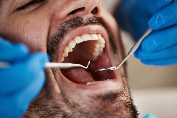 Best Chipped Tooth Repair Near Me  in Scottville, MI